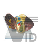 The model of hepatocarcinoma